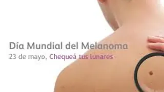 Melanoma: se diagnostican más de 1.600 casos cada año en Argentina